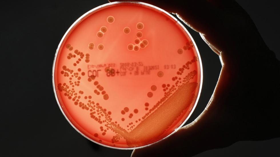 New ‘superbug’ becomes first drug-proof bacteria to hit U.S image