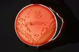 New ‘superbug’ becomes first drug-proof bacteria to hit U.S
