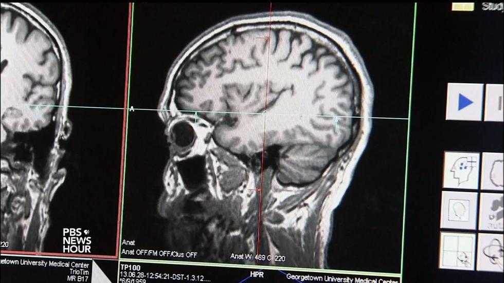 Why psychedelic drugs are having a medical renaissance image