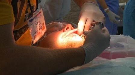 Video thumbnail: PBS NewsHour In a Town Called Grundy, Some Dental Relief for...