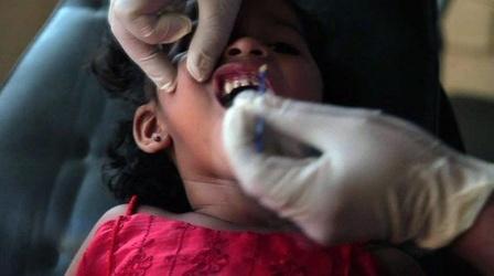 Video thumbnail: PBS NewsHour In El Salvador, Tooth Decay Epidemic Blamed on Junk Food