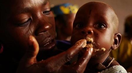 Video thumbnail: PBS NewsHour Plumpy'nut: The Peanut Paste That Could Save Millions