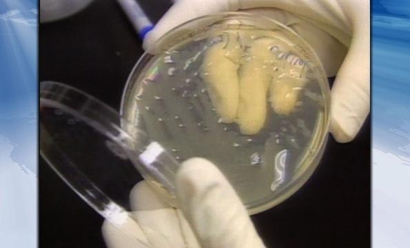 Frontline: Evidence Questioned in 2001 Anthrax Case