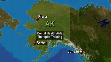 Video thumbnail: PBS NewsHour A Solution to Alaska's Rural Dental Problems?