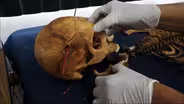 From Guatemalan, Scientists Unearth Signs of Genocide