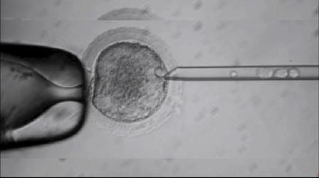 Video thumbnail: PBS NewsHour Major Embryonic Stem Cell Advance Raises Ethical Quandaries