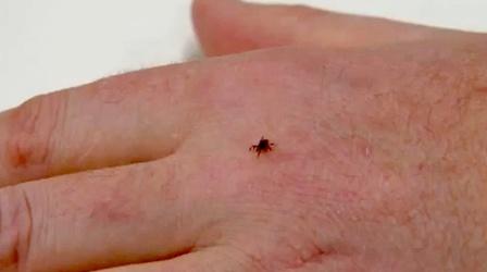 Video thumbnail: PBS NewsHour Revised Lyme Disease Statistics Raise New Questions