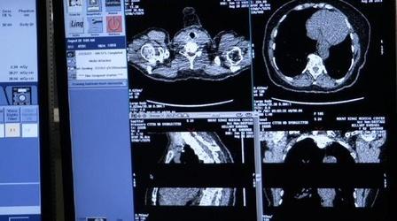 Video thumbnail: PBS NewsHour Can CT scans for smokers save lives?