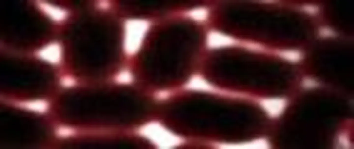 Killer Microbe