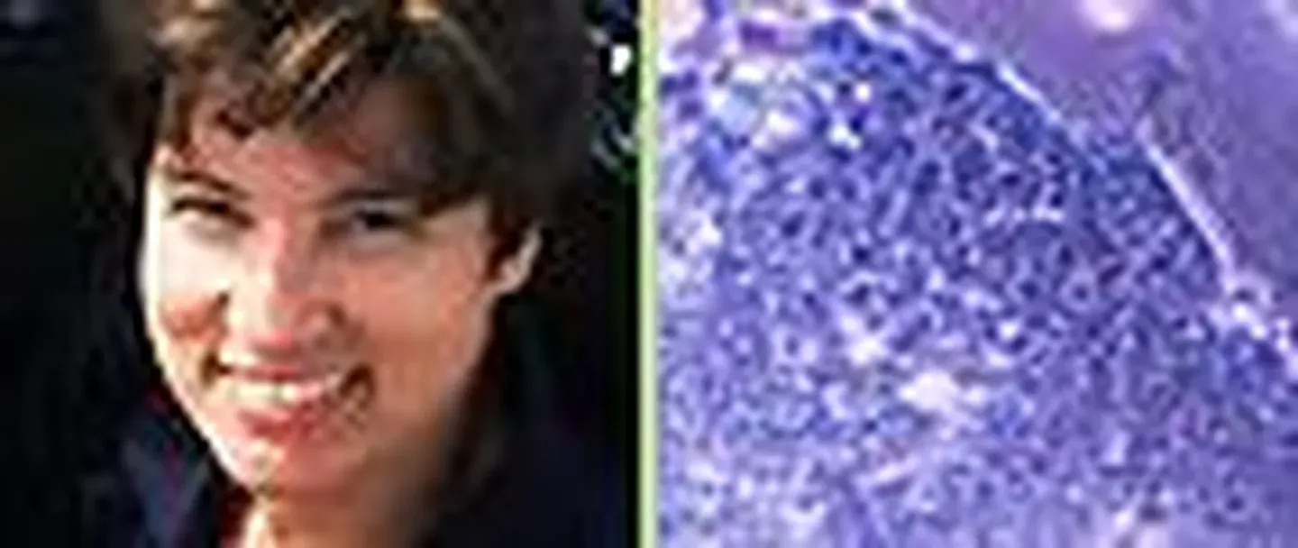 Leeches, The Search for ET, Stem Cells Breakthrough,...