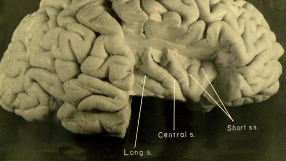 S6: New Photos of Einstein’s Brain image