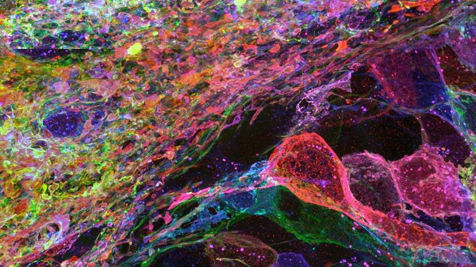 A New Way to See the Brain image