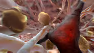 Can Alzheimer's Be Stopped?