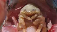 The Tongue-Eating Parasite