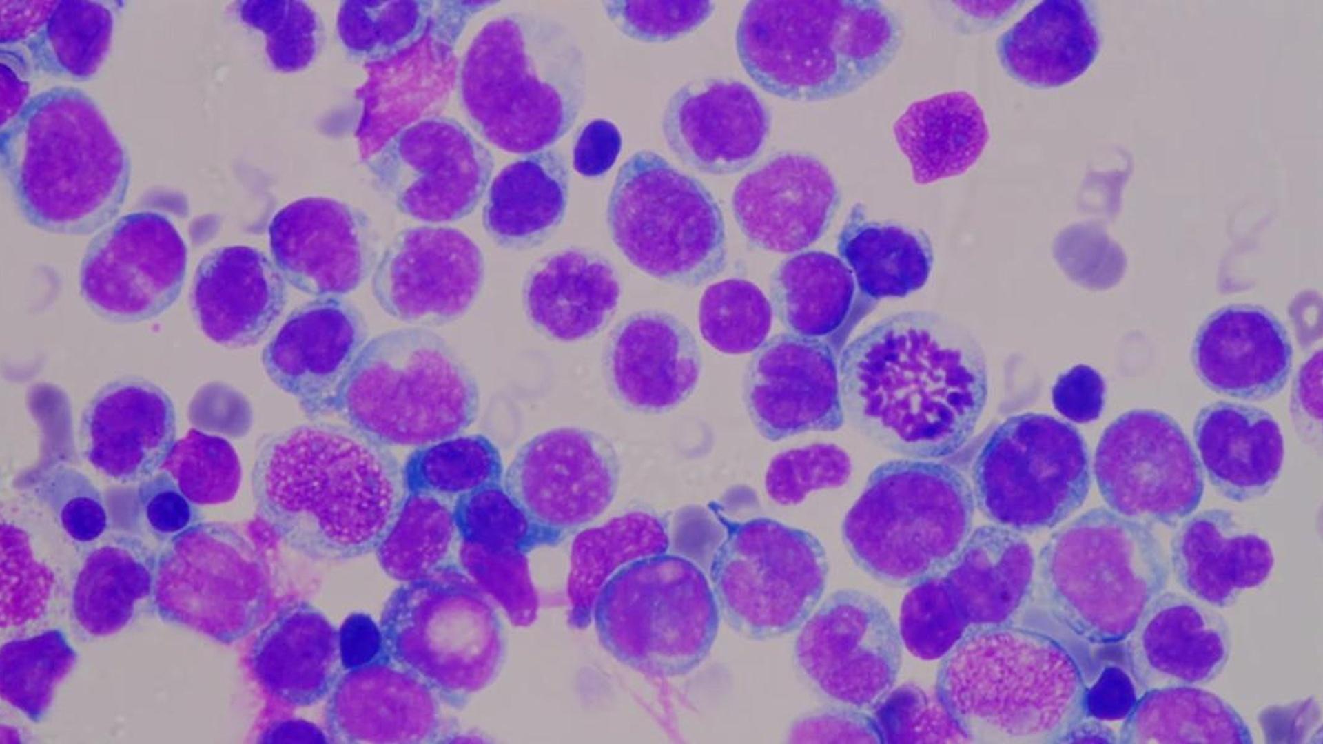 the emperor of all maladies a biography of cancer
