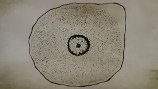 The Discovery of the Oncogene in Carcinogeneis
