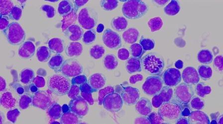 Video thumbnail: Cancer: The Emperor of All Maladies What is Cancer?