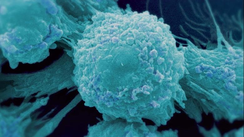Cancer: The Emperor of All Maladies Image