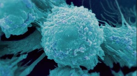 Video thumbnail: Cancer: The Emperor of All Maladies Why Cancer is so difficult to cure
