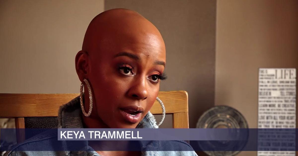 Chicago Tonight | She Was Bullied for Alopecia. Now She is Bald and Proud. | Season 2019