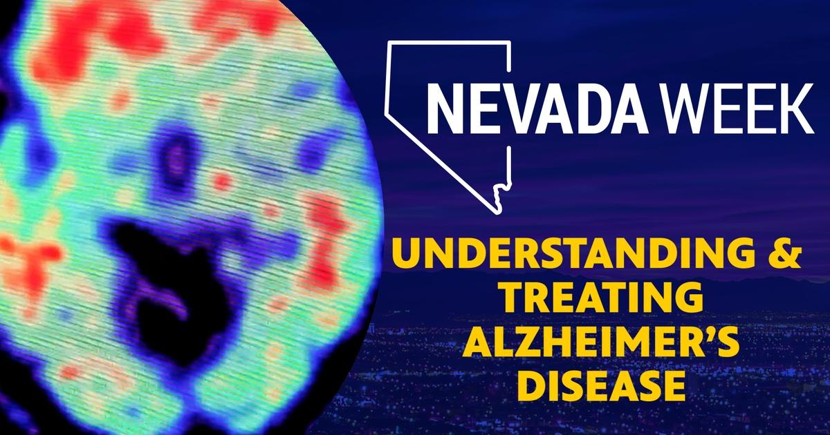 Nevada Week | Understanding & Treating Alzheimer’s Disease | Season 6 | Episode 50