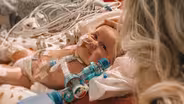 The revolutionary procedure that's saving newborn lives