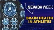Brain Health in Athletes