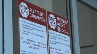 Measles Cases in Montana/Wilderness Study Areas