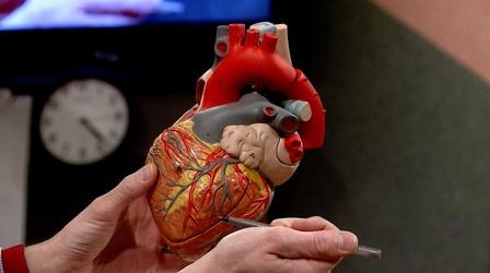 Video thumbnail: Ask the Doctors Heart & Vascular