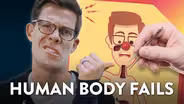 Evolution Fails in the Human Body