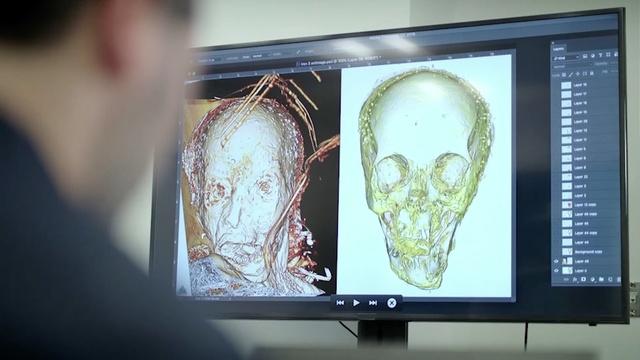 Forensic reconstruction reveals a face from history