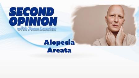 Video thumbnail: Second Opinion with Joan Lunden Alopecia Areata