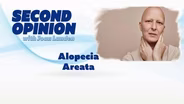 Alopecia Areata