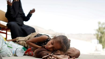 Video thumbnail: PBS NewsHour Yemen's spiraling hunger crisis is a man-made disaster