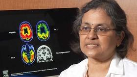 Video thumbnail: KLRN SciTech Now March 21, 2019 | Link between gait and Alzheimer's