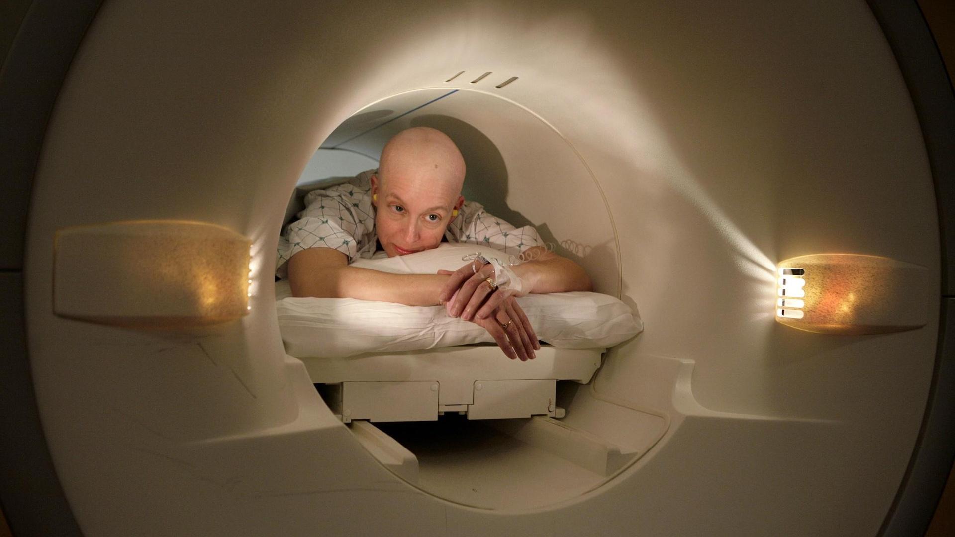 The alarming rise of cancer and steps to lower the risk | Horizons from ...