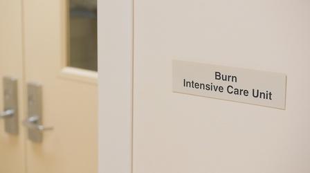 Video thumbnail: Cycle of Health Burn Foundation of CNY