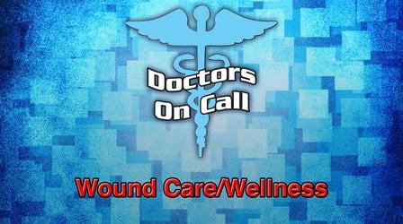 Video thumbnail: Doctors On Call Wound Care/Wellness