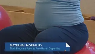 Black Women More Likely to Die From Pregnancy-Related Complications