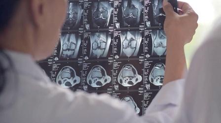 Video thumbnail: Call The Doctor Breast Cancer: Finding It, Treating It, Living With It