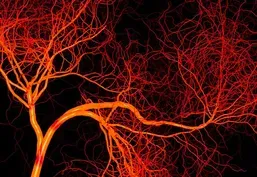 Heart and Stroke February 15