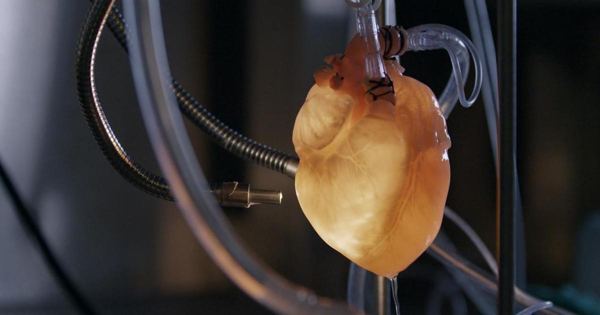 NOVA | Could Cadaver Organs Save Your Life? | Season 45 | Episode 9 | PBS
