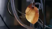 Could Cadaver Organs Save Your Life?
