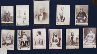 Who Were the Circus "Freaks"?