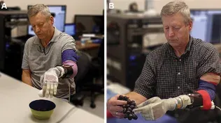 This robotic hand can partially restore a sense of touch
