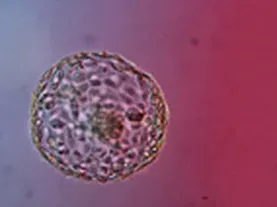 Gene Editing Human Embryos