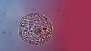 Gene Editing Human Embryos