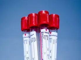 The Quest for a Simple Cancer Test