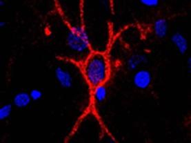 Unlocking the Brain's Secrets