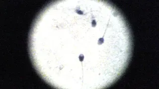 Sperm Count is Decreasing in Rich Nations
